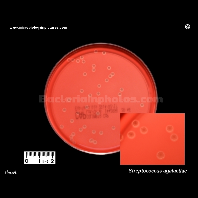 Streptococcus agalactiae (GBS)