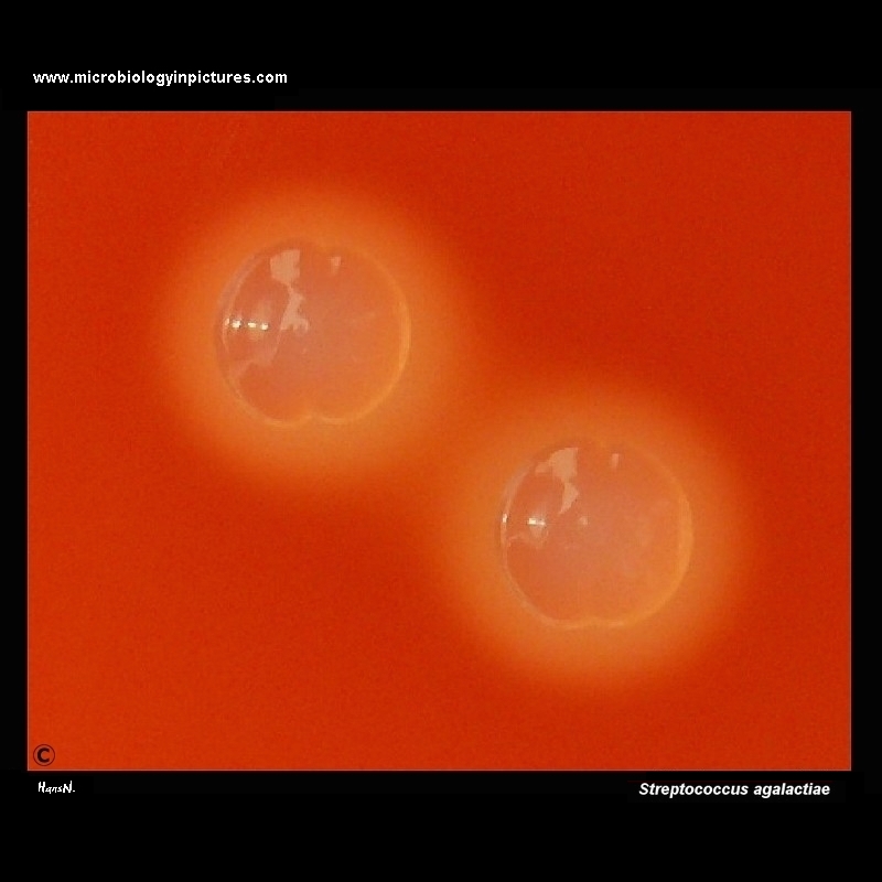 Streptococcus agalactiae colonies on Columbia blood agar