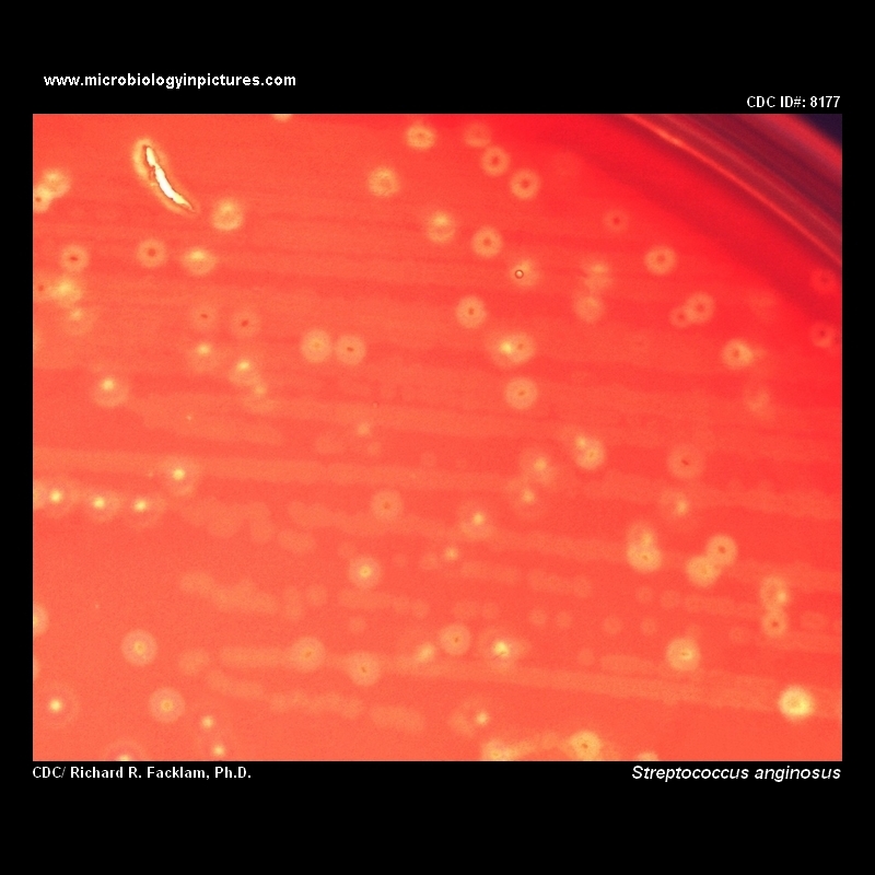 streptococcus anginosus
