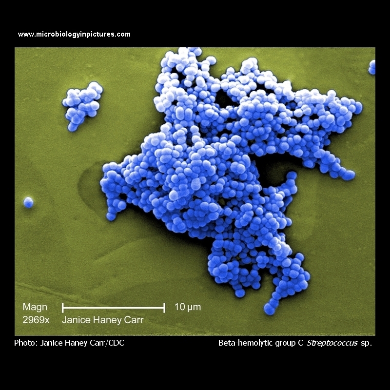 streptococcus Group C stain