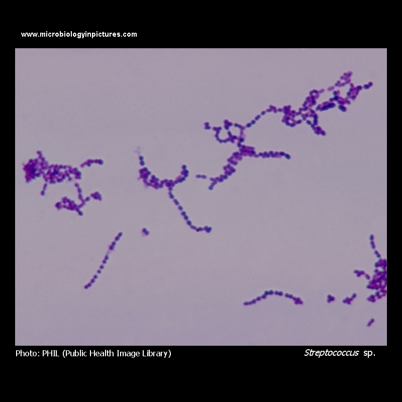 streptococcus Gram stain