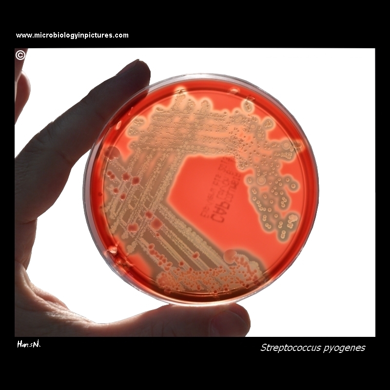 Strepto.pyogenes (GAS)