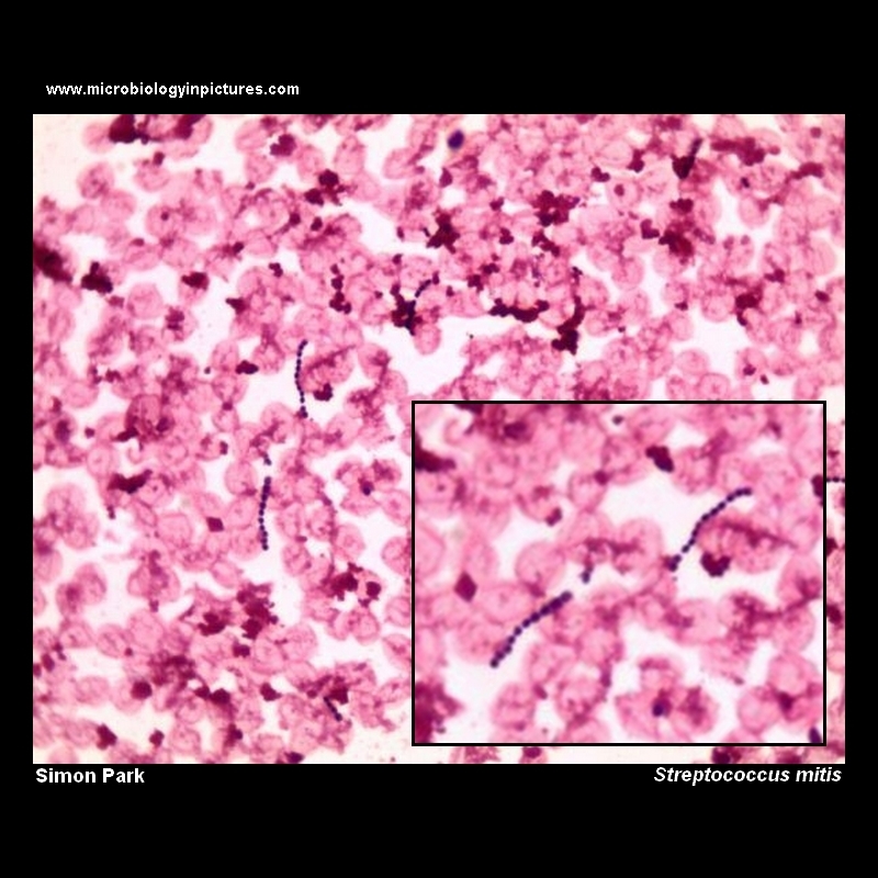 Streptococcus mitis