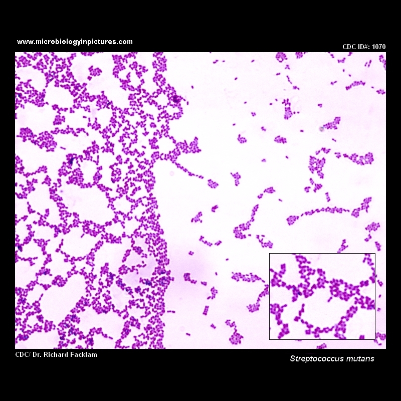 streptococcus mutans micrograph