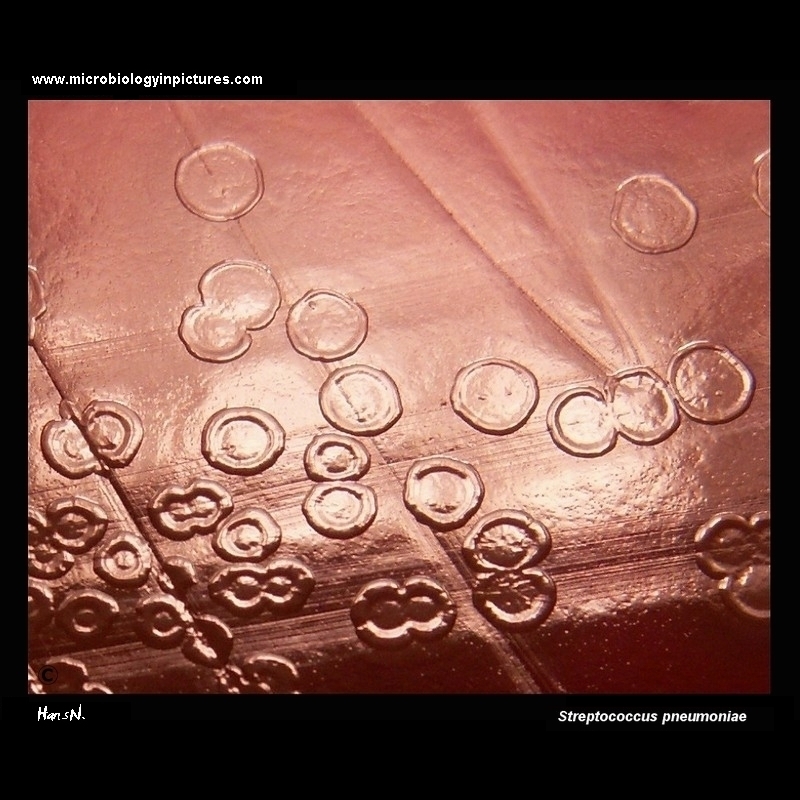Streptococcus pneumoniae on blood agar