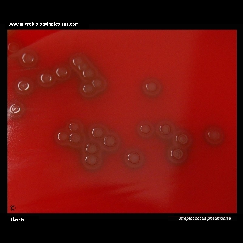 Streptococcus pneumoniae: alpha-hemolysis on blood agar