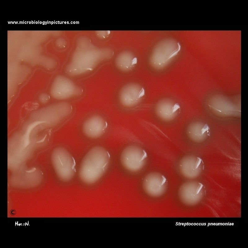 virulent strain of Streptococcus pneumoniae on blood agar