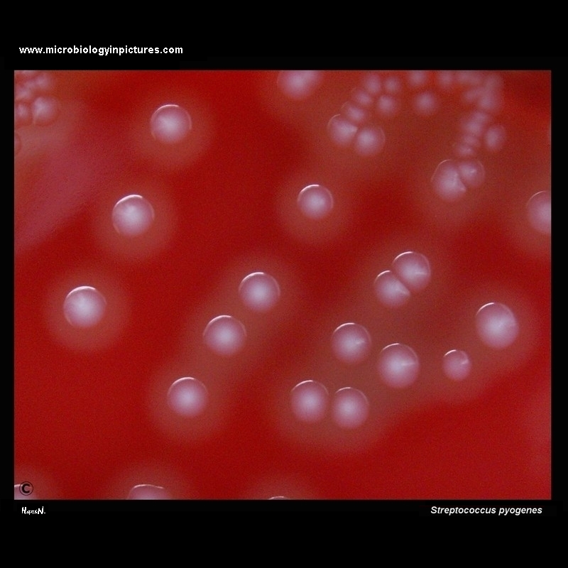 Streptococcus pyogenes colonies on blood agar