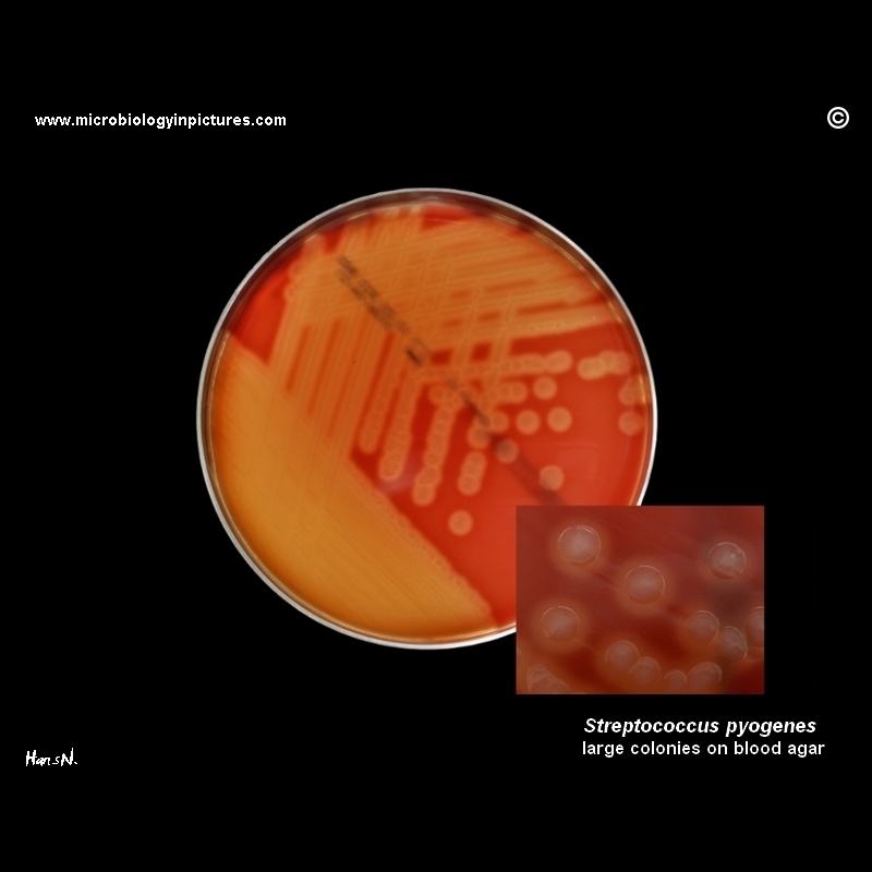 Streptococcus pyogenes large colonies on blood agar