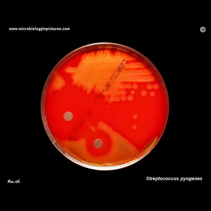 streptococcus pyogenes penicillin susceptible