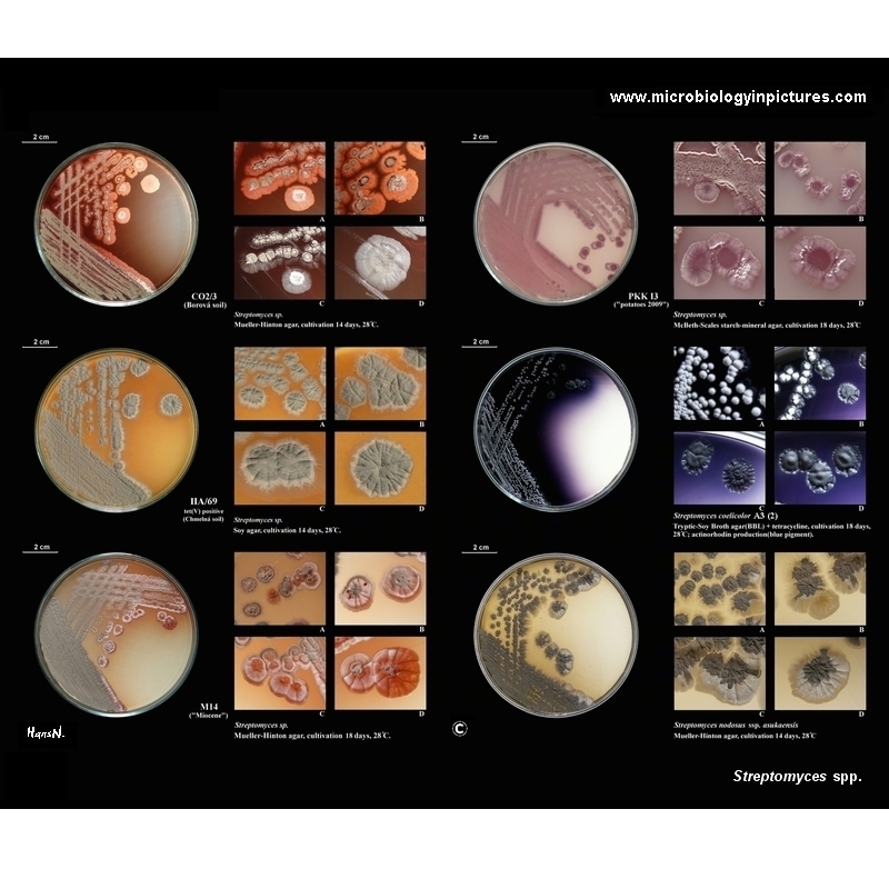 Streptomyces species colonies on agar plates
