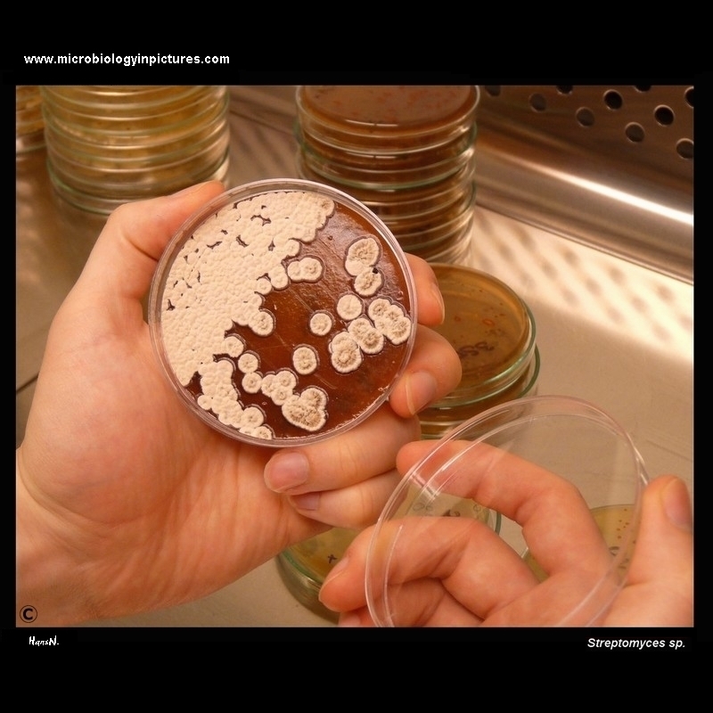 colonies of streptomycete on agar plate