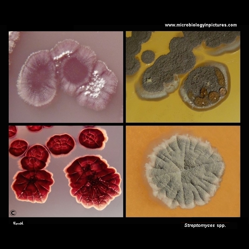 Streptomyces spp. colonies