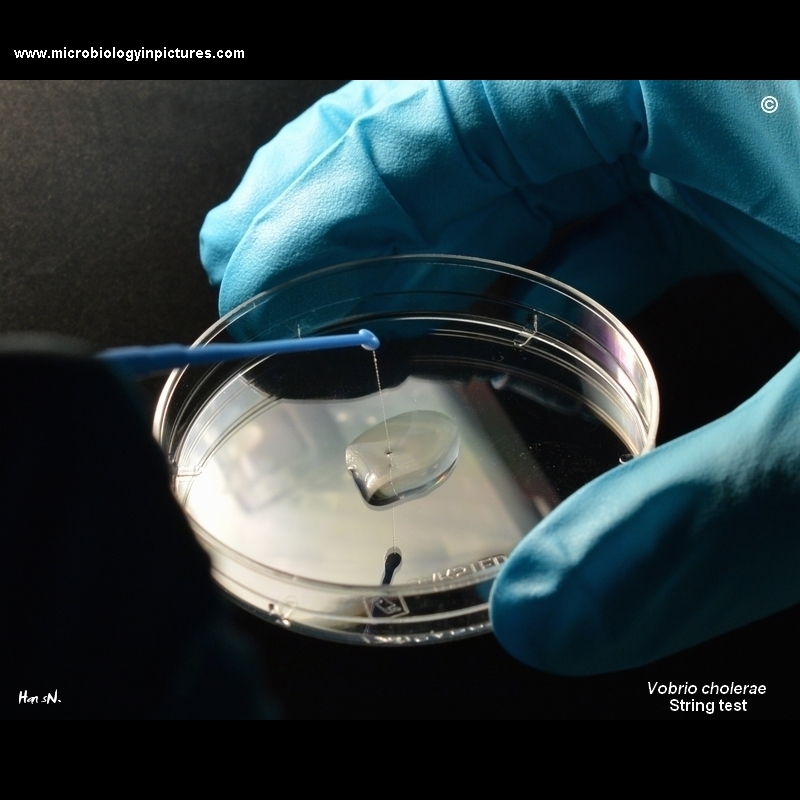 vibrio cholerae string test