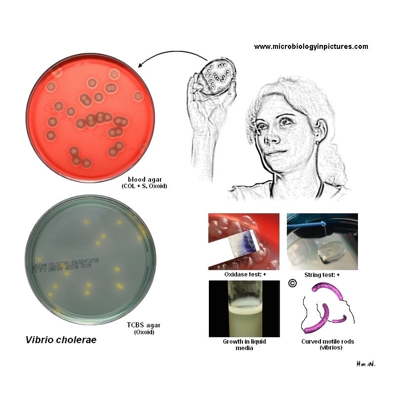 tests for identification of vibrio cholerae