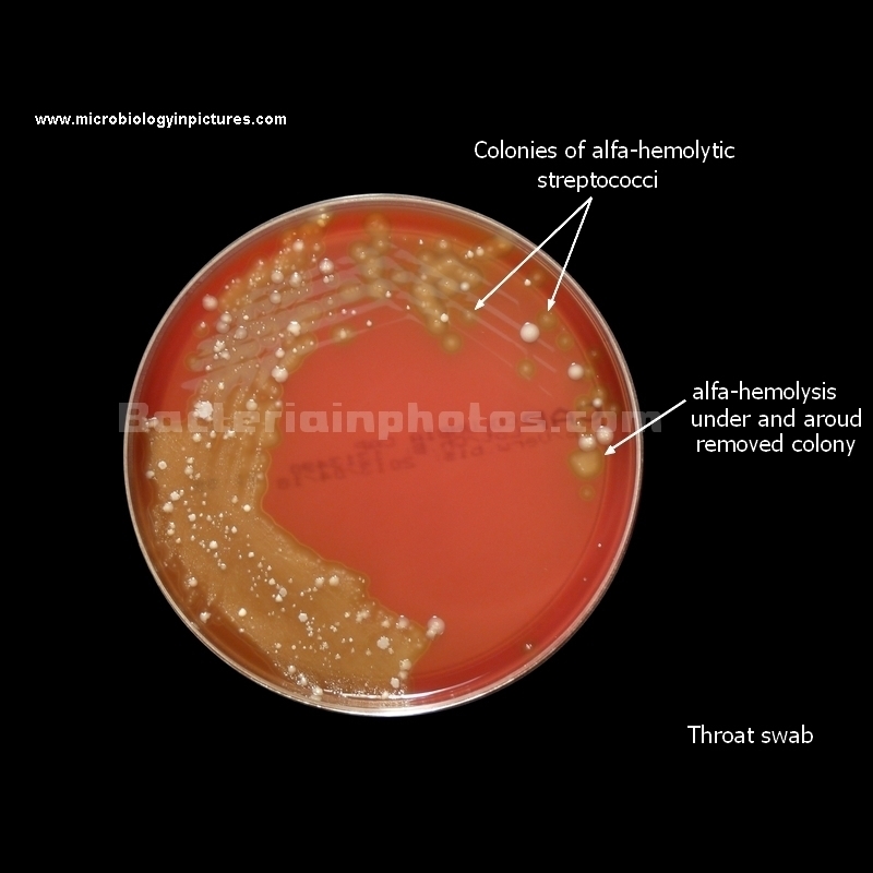microflora in throat swab