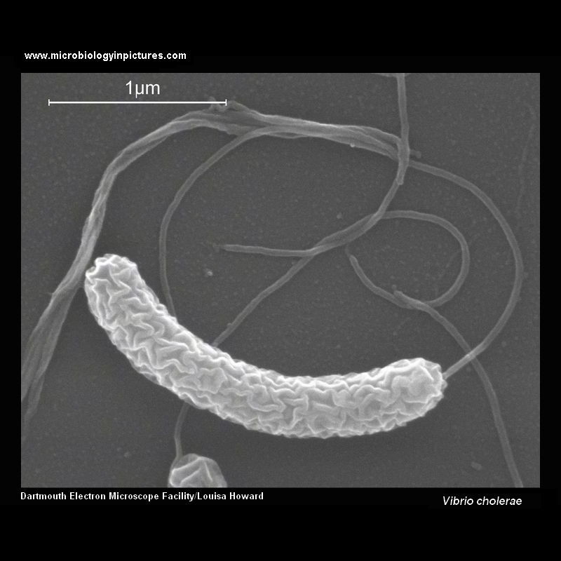 vibrio cholerae micrograph (SEM)