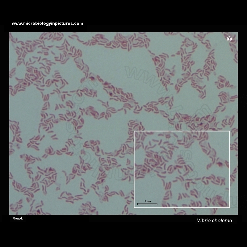 vibrio cholerae Gram