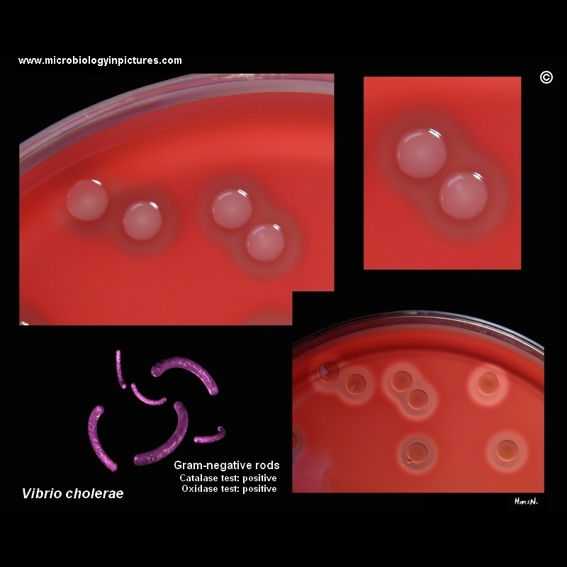 vibrio cholerae morphology