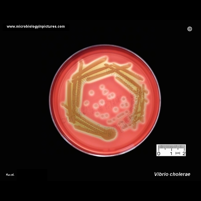 vibrio cholerae on agar plate