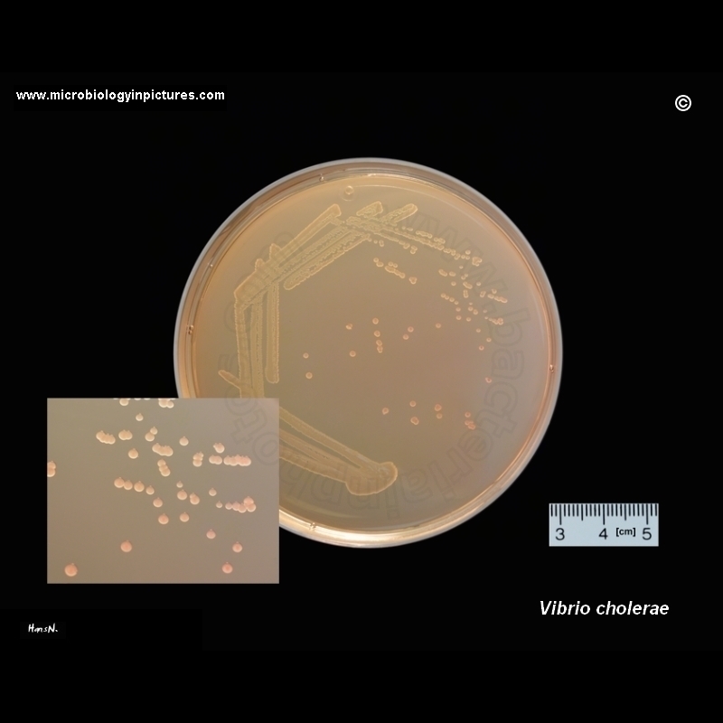 vibrio cholerae on MacConkey