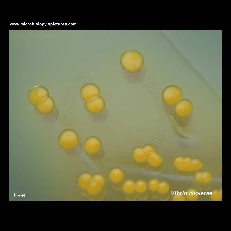 vibrio cholerae appearance on TCBS