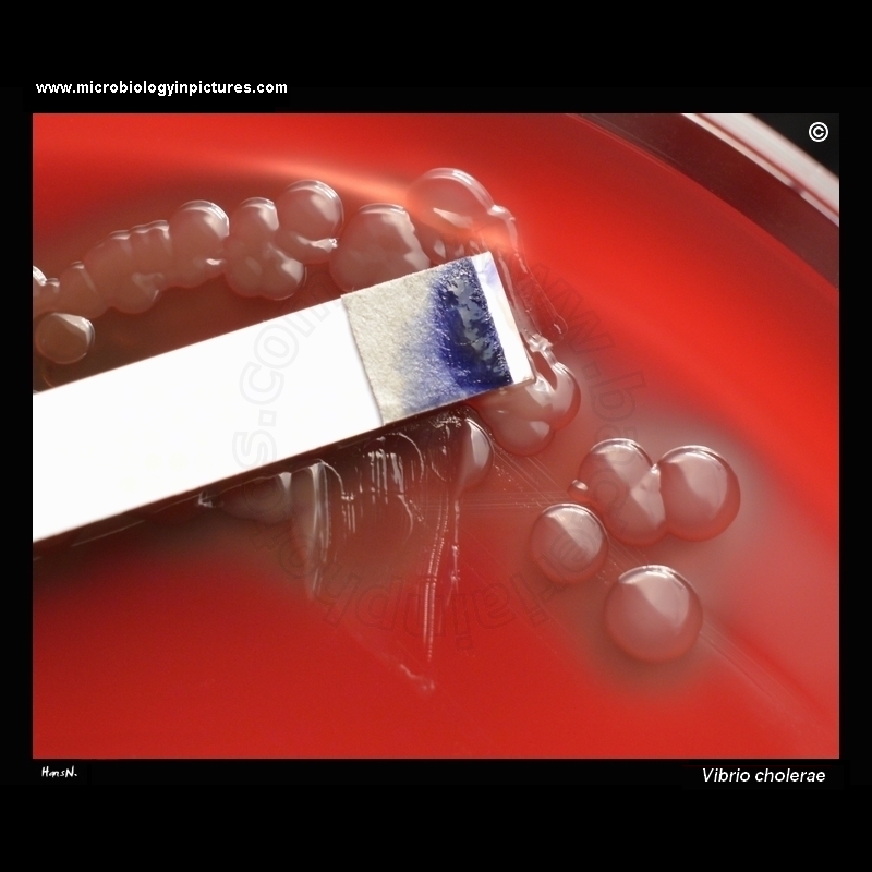 vibrio cholerae oxidase test