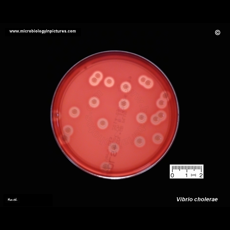 vibrio cholerae on blood agar