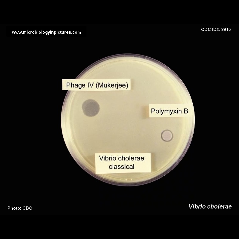 vibrio cholerae polymyxin B sensitivity