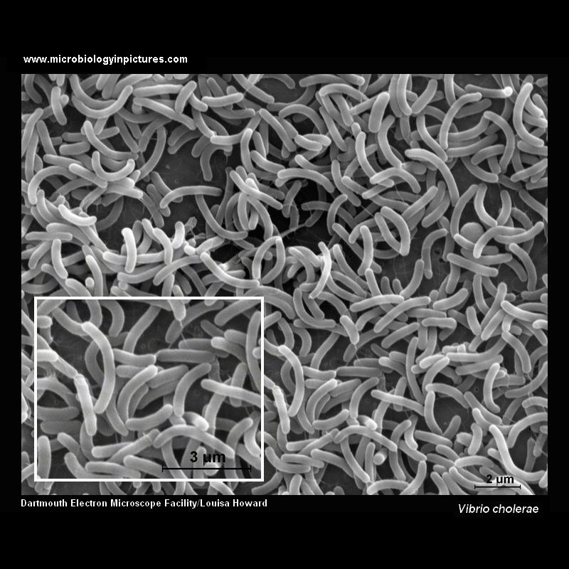 vibrio cholerae SEM