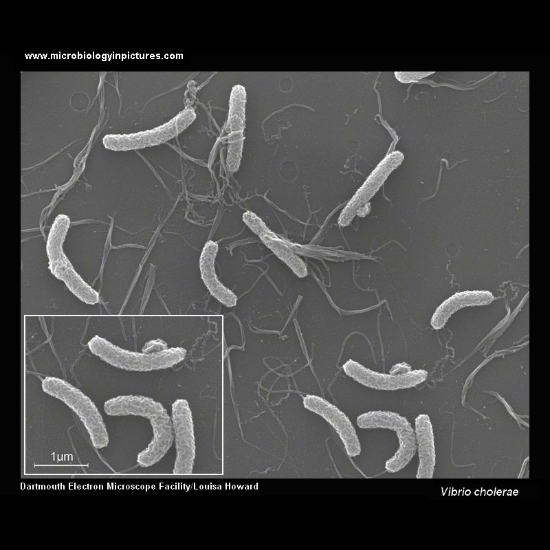 vibrio cholerae appearance under microscope