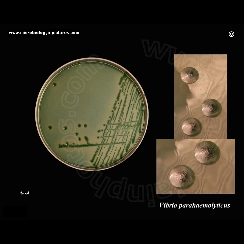 vibrio parahaemolyticus morphologyon TCBS