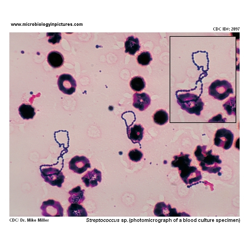 viridans streptococci micrograph