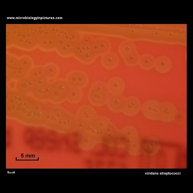 viridans streptococci colonies on blood agar