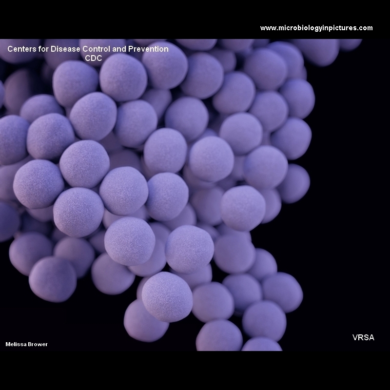 VRSA S.aureus 3D image