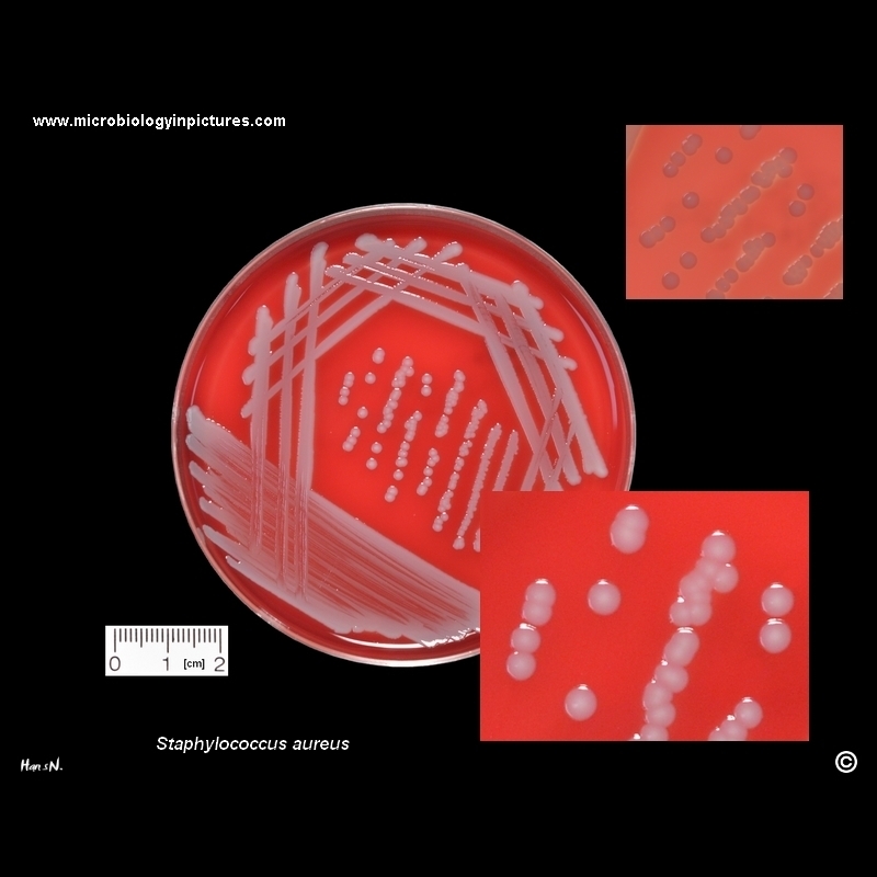nonpigmented Staphylococcus aureus
