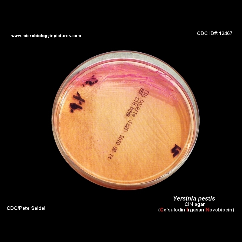 yersinia on CIN agar