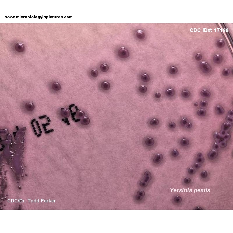 yersinia pestis CIN agar