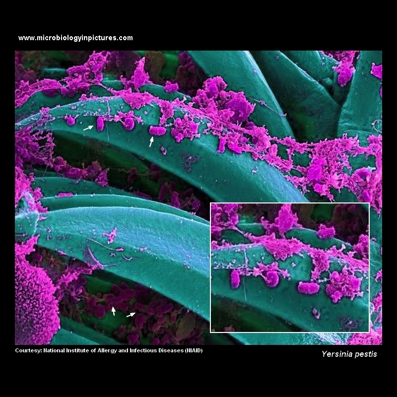 yersinia pestis SEM microscopy