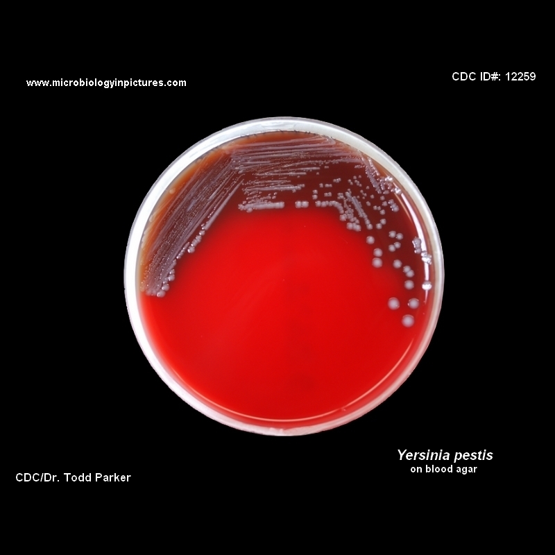 yersinia pestis blood agar