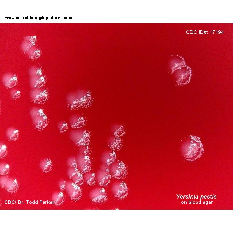 yersinia pestis colonies on agar