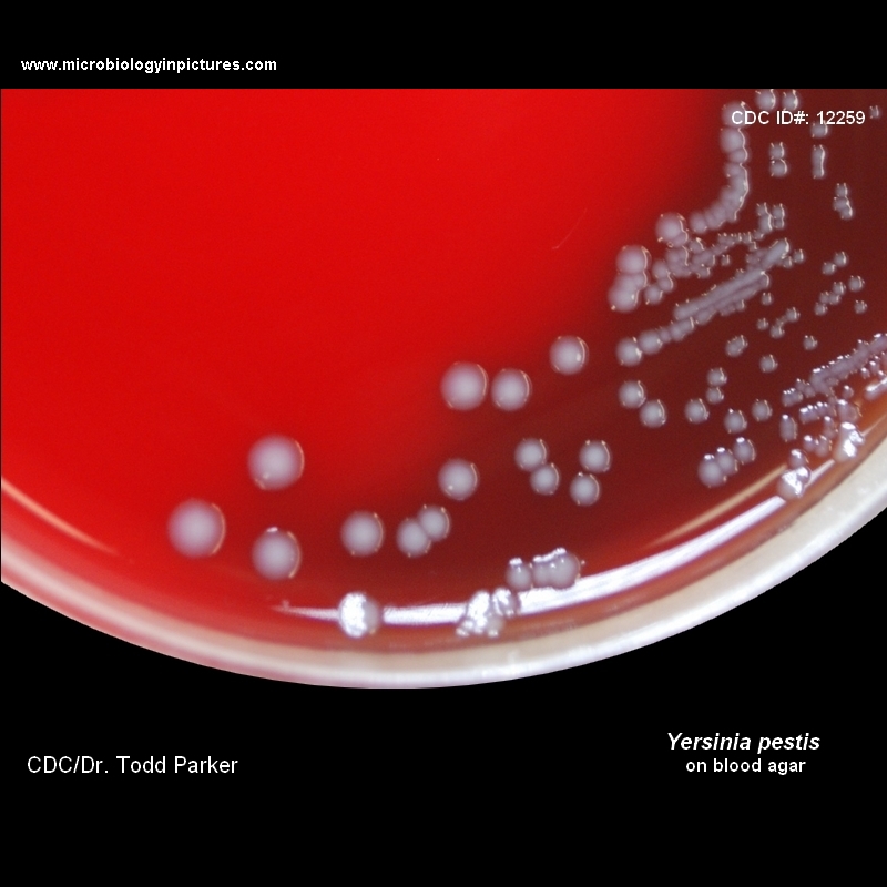 yersinia pestis photograph