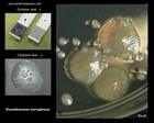 pseudomonas aeruginosa oxidase test