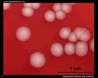 Salmonella