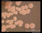 serratia marcescens on MacConkey agar