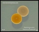 Staphylococcus epidermidis colony on mannitol salt
