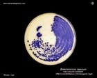Biochemical identification for Enterococcus