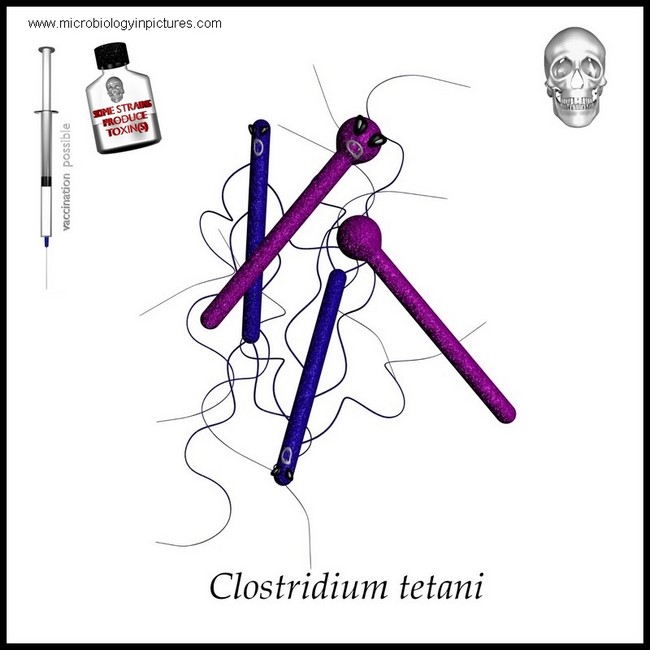 Clostridium tetani