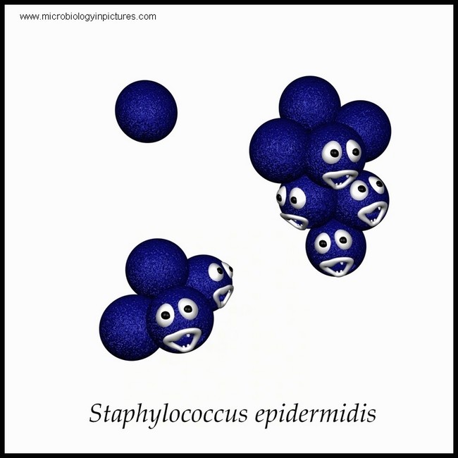 Staphylococcus epidermidis