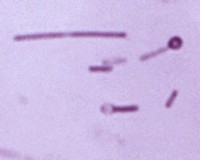 C.tetani Gram stain